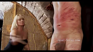 Distressing White-hot Bruises greater than Scanty Guy's Flesh